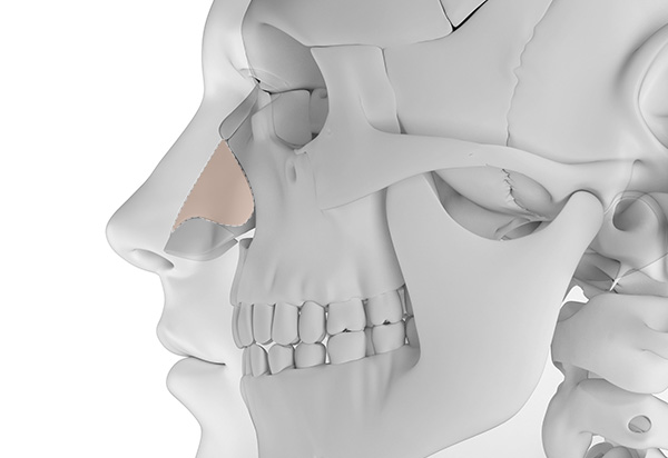 Autologous Tissue Rhinoplasty