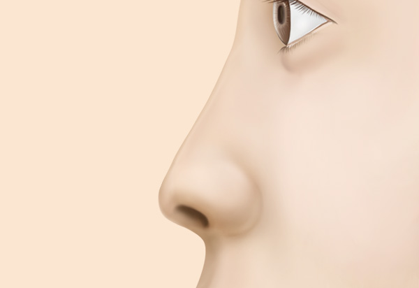 Type-Specific Rhinoplasty