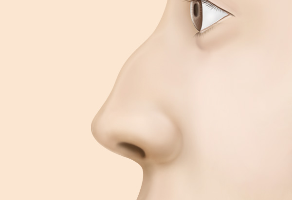 Type-Specific Rhinoplasty