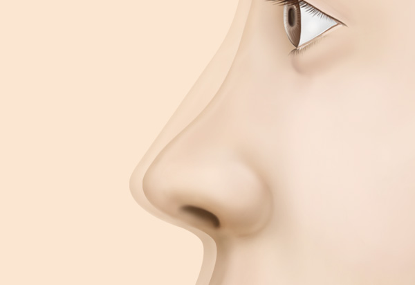 Rhinoplasty Revision